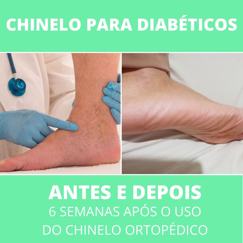 Chinelo Masculino para Diabéticos - Frete Grátis - TechnoLoja