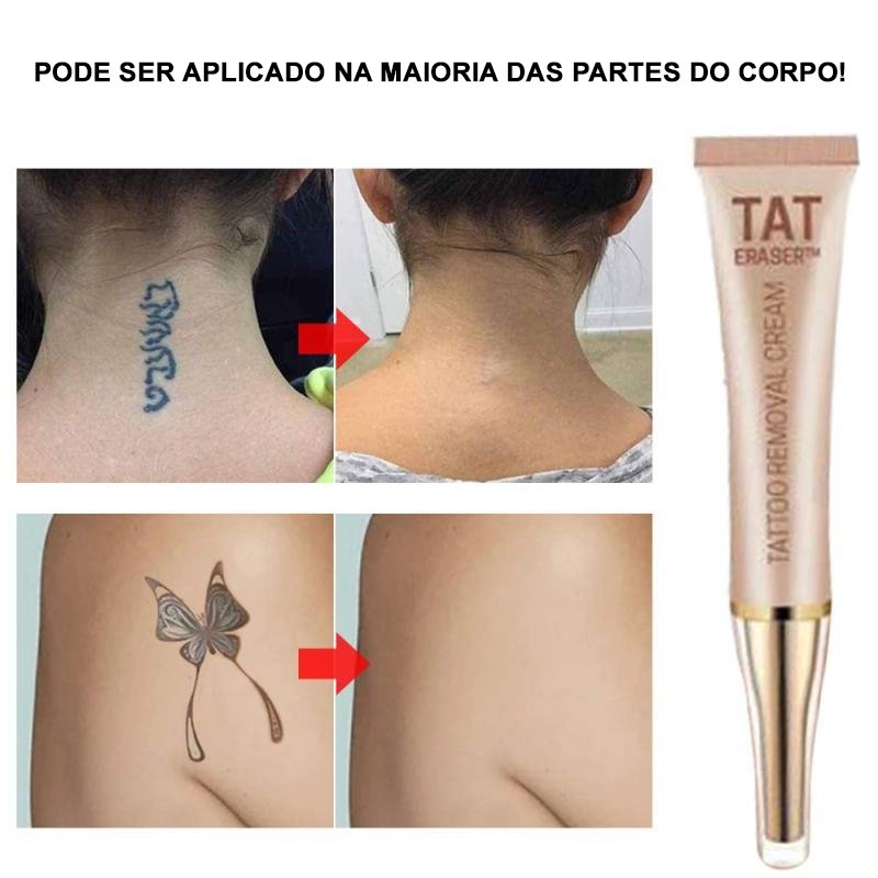 REMOVEDOR DE TATUAGEM - CLEAN PELE - TechnoLoja